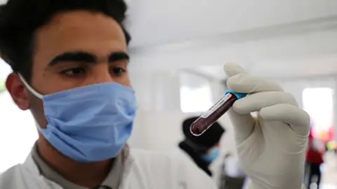 Getty Images A doctor with a vial of blood in Algiers - June 2020