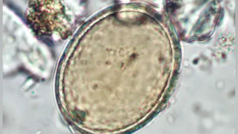 Tianyi Wang Roundworm egg from medieval friar