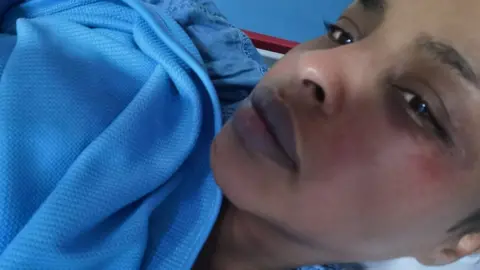 Niyad Farah with black eye