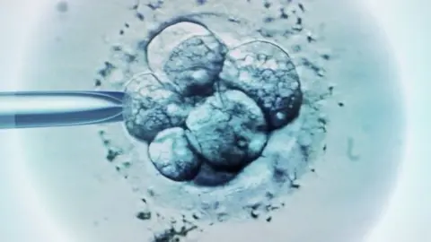 Science Photo Library cell being fertilised