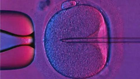 PHANIE/SCIENCE PHOTO LIBRARY In Vitro Fertilization