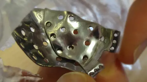 Abertawe Bro Morgannwg University Health Board a close up of a facial implant