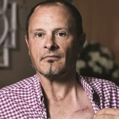 Matt Eagles Mat Eagles