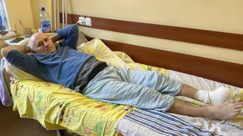 Serhiy was injured by a landmine explosion losing his foot