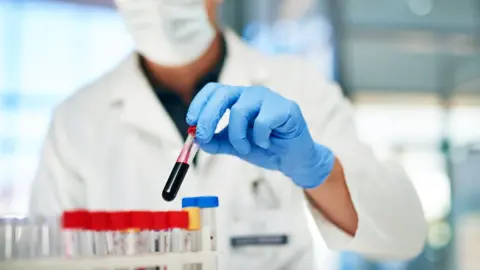 Getty Images Blood vial image