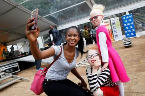 Reuters Participants are seen backstage at Mr and Miss Albinism beauty pageant