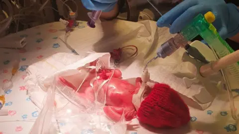 Jessy Williams Sky in hospital