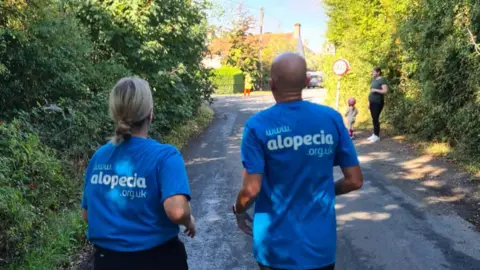 Linda Duncan/Alopecia UK Gemma Nachman and Linda Duncan