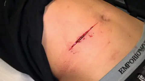 Thames Valley Police Stomach slash