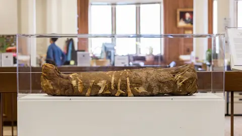 Northwestern University Mummy in display case