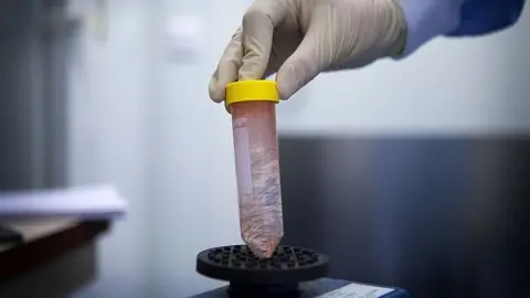 BSIP/Getty Images Cancer research laboratory