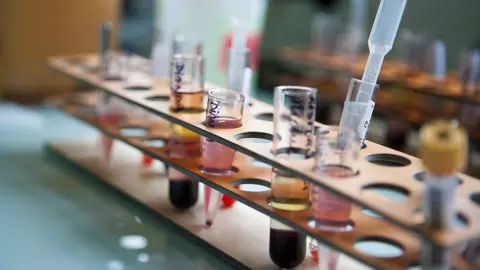 BSIP/gETTY IMAGES Blood samples in a laboratory