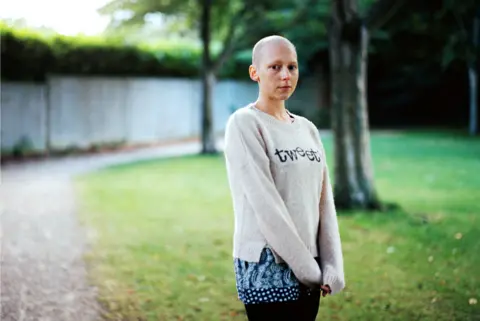 Carly Clarke Carly Clarke after shaving her head