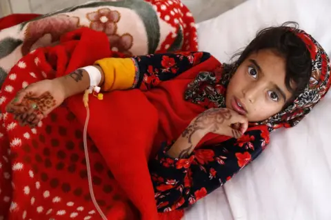 Mohammed Hamoud / Getty Images A Yemeni girl who is infected with cholera receives treatment at a hospital in Sana'a, Yemen