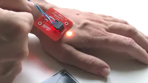 Patrick Paumen Patrick Paumen's payment chip implant lights up