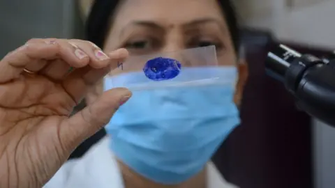 A doctor looks at TB sample in TMC's CR Wadia Hospital, in Thane