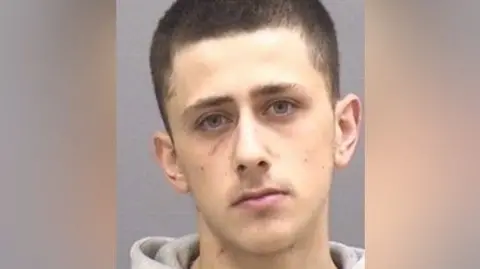 Aydin Kolliari, a short haired white man with bruising around his eye