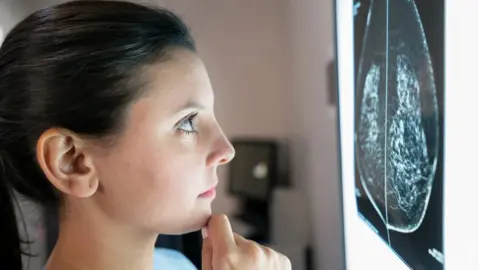 Getty Images Doctor looking at mammogram