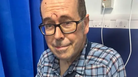 Rory Cellan-Jones Rory with facial injury