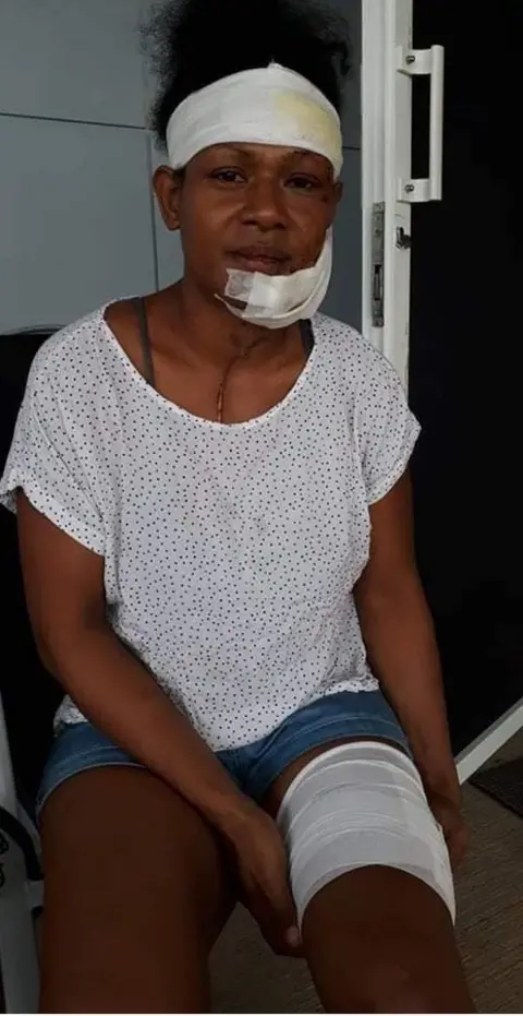 De'Bono Paraka Facebook Debbie Kaore in bandages