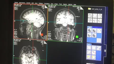 BBC Images of brain scans