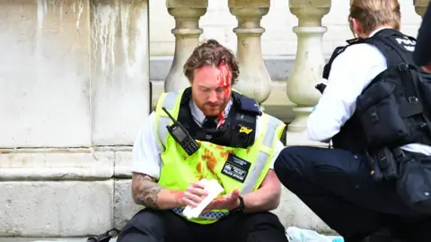 Reuters A police officer receives medical attention after police clashed with demonstrators in Whitehall