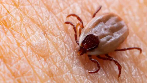 Getty Images A tick on human skin