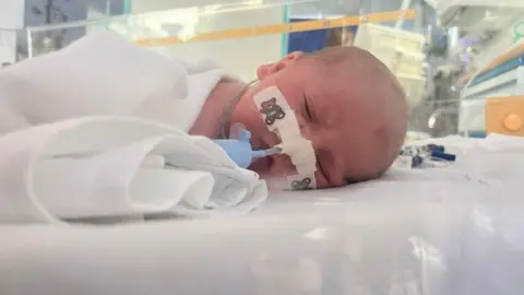 Lloyd Irish A baby in an incubator with a ventilator