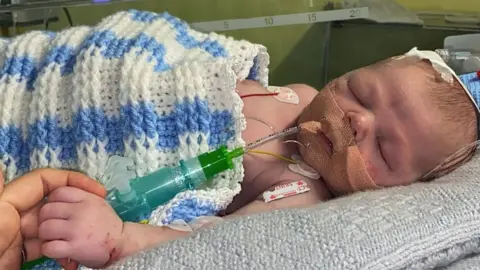 Chris Picture of Albie in intensive care