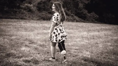 LAUREN SPINKS Victoria post op