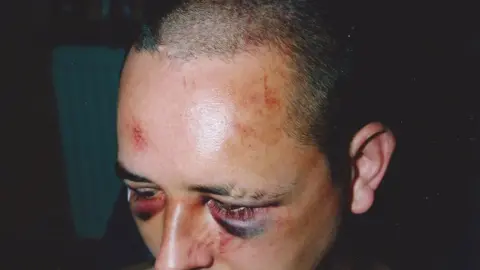 Colin Robertson A picture of Colin's injuries taken 10 days after the attack