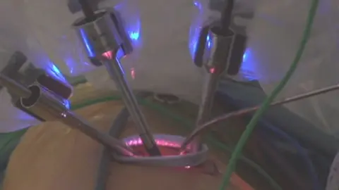 South Tees NHS Trust Surgery aided by robots