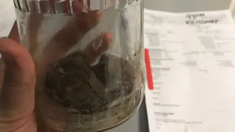 Alexandra Loredana Alexandra Loredana holds up a jar with bandages she found inside her body seven weeks after childbirth