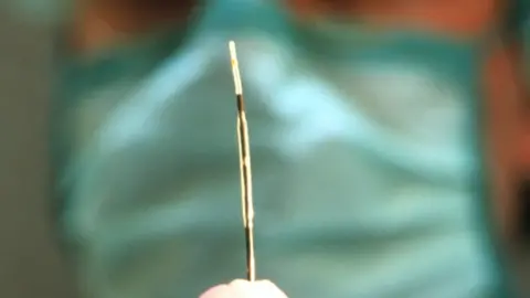 Science Photo Library Stent