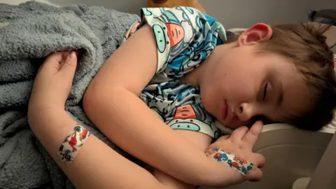 Supplied A young boy sleeping on a bed with a grey blanket pulled over him. He has two plasters on his arms, each with dinosaur cartoons on them.
