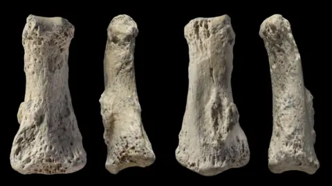 Ian Cartwright Four images showing different sides of a finger bone
