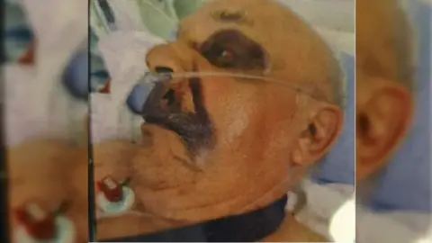 West Midlands Police Injured man