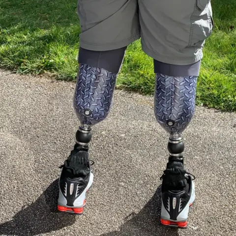 Instagram/Bionicsurgeon A shot of Neil Hopper's prosthetic legs shot from behind. They have a blue and grey pattern and he is wearing black and white trainers. 
