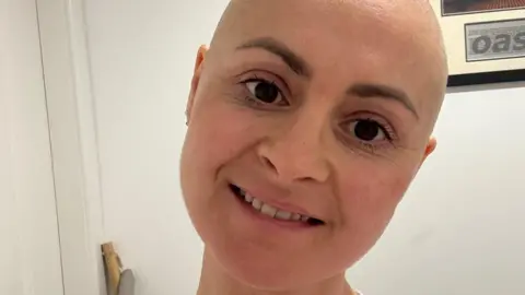 Jo smiles at the camera in a self-shot picture. She has no hair after chemotherapy and has dark eyes.