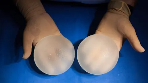 VOISIN/PHANIE/SCIENCE PHOTO LIBRARY PIP implants