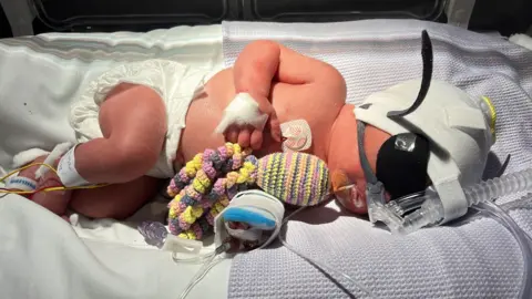 Bailey Thompson A small baby lying on her side in a medical cot. She's wearing a white nappy and a white hat, and has a crocheted toy octopus next to her. There's a breathing tube over her nose, and a black mask covering her eyes. The cot sheets are white and there's a light purple blanket.