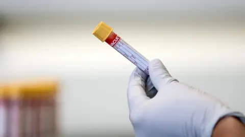 Simon Dawson Blood sample being held in a gloved hand