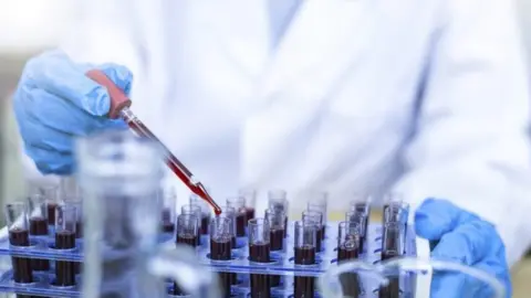 Getty Images Blood testing in a laboratory