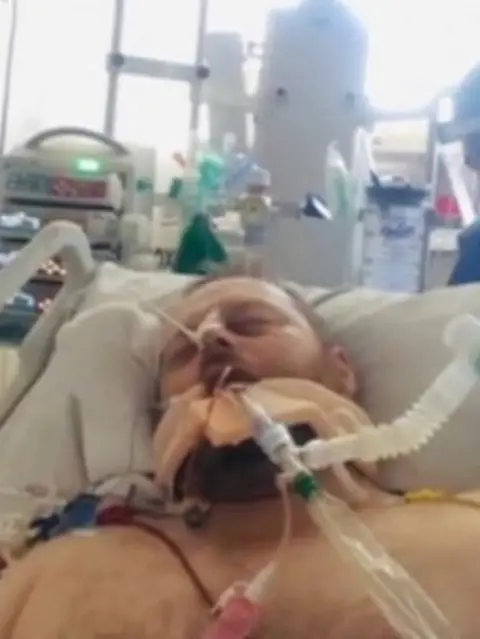 Phil Dolby Phil Dolby on a ventilator