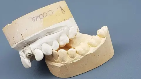 Items form the collection