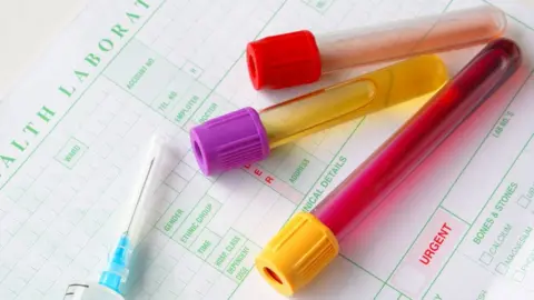 Thinkstock Drug tests generic pic