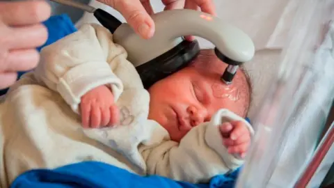 BSIP/Getty Images ABR testing on a newborn baby