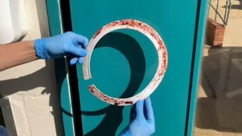 RSPCA Plastic ring removed from seal