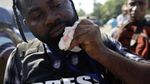 Reuters Photojournalist Dieu Nalio-Chery holds a gauze next to his mouth in Port-au-Prince, Haiti