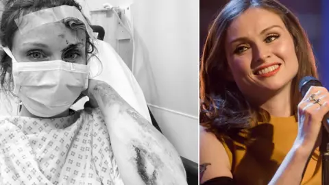 Sophie Ellis-Bextor / BBC Sophie Ellis-Bextor